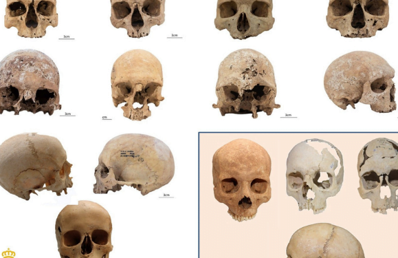 Secrets of the bones