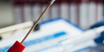 Antigen tests: what’s the problem?