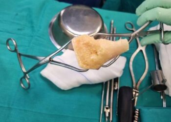 First bone graft on Lanzarote