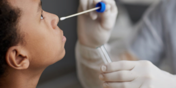 Where to get tested