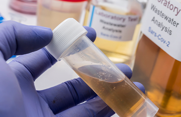 Flushing out the coronavirus
