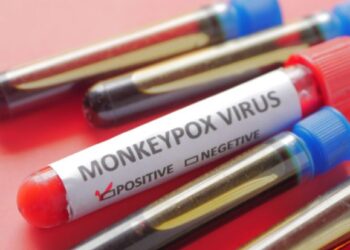 First confirmed case of Monkeypox on Lanzarote