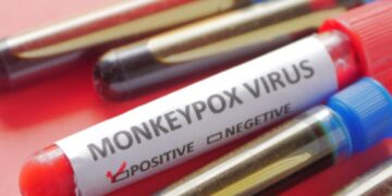 First confirmed case of Monkeypox on Lanzarote