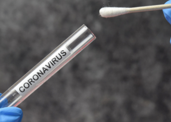 Need to know: Covid-19 Tests
