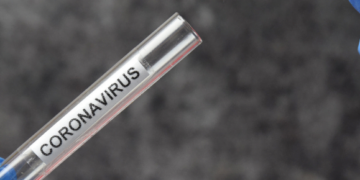 Need to know: Covid-19 Tests