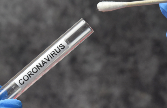 Need to know: Covid-19 Tests