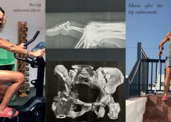 Maria’s road to recovery