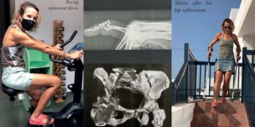 Maria’s road to recovery
